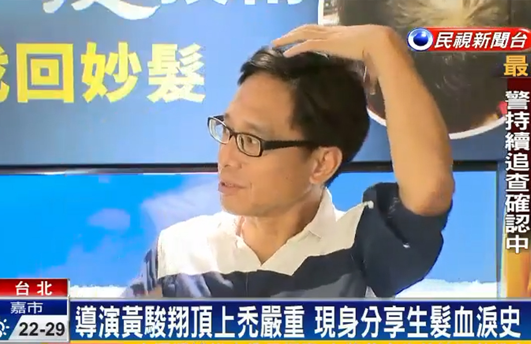 複合式生髮,落髮,生髮,植髮,楊氏羅丹